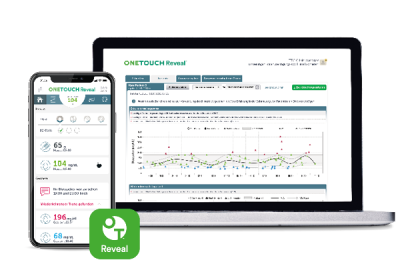 OneTouch ReveApp auf Smartphone und Laptop – Blutzuckerdaten im Überblick